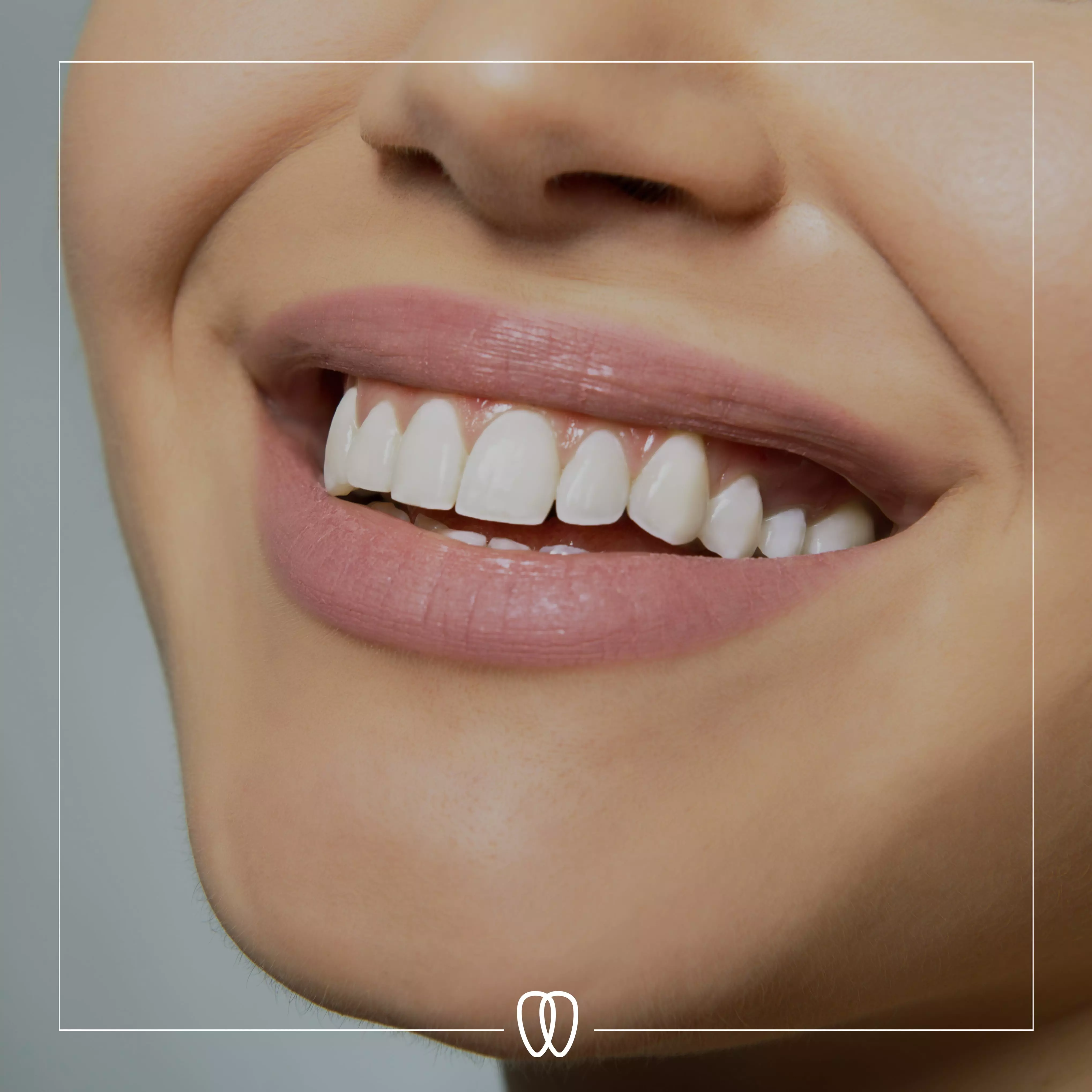 Estética Dental Granada